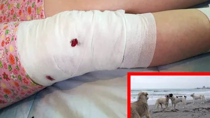 O turistă din Germania a fost sfâșiată de o haită de câini din Mamaia. Soțul femeii, dezgustat de birocrația România. Câte uși i-au fost închise în nas