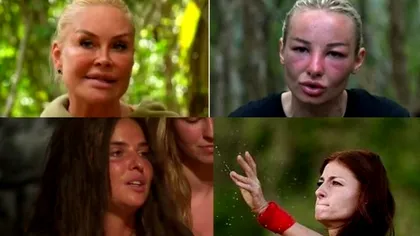 De ce concurentele de la Survivor 2023 au fețele umflate. Motivul, explicat de medici. Ce se întâmplă cu ele, de fapt