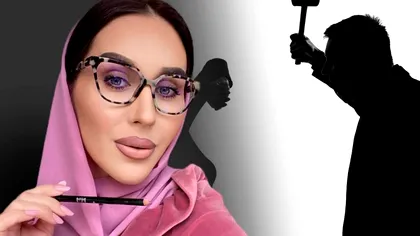 Cum a ajuns să arate Dana Roba, după ce a fost mutilată de soț. Primele declarații ale vedetei: ”Arătam ca un om mort”