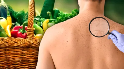 Legumele și fructele din bucătărie care te scapă de petele solare. Așa te bucuri de concediu fără probleme