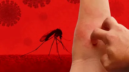 Alimentul banal care te scapă de înţepăturile de ţânţari. Aşa nu vei mai avea probleme cu insectele!