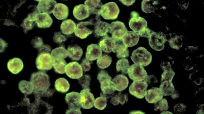 Un copil s-a infectat cu o amibă periculoasă, după ce a fost la plajă. Medicii, uimiţi de ce au găsit în creierul lui