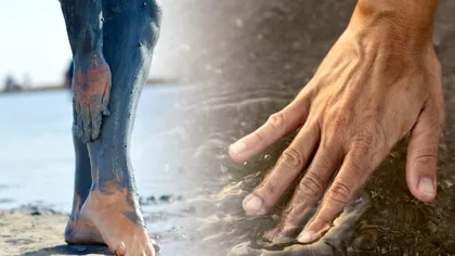 Nămolul vândut pe plajele din România ar fi colectat din zona de deversare a unui sanatoriu. Alertă de infecții pe litoralul românesc