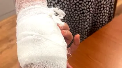 Femeie din Arad, mușcată de un șacal în centrul orașului. Cum a reușit animalul sălbatic să prindă mâna victimei