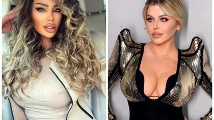 Bianca Drăguşanu, fără milă. Cum a numit-o pe Loredana Groza, totul a pornit de la operaţiile estetice: 