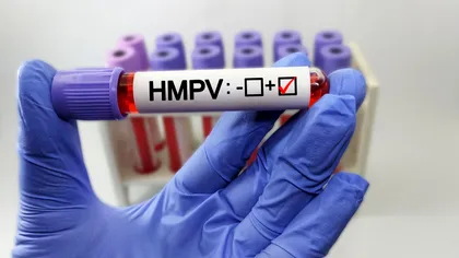 Un copil de 12 ani, primul caz de HMPV confirmat în București. A fost diagnosticat inițial cu pneumonie