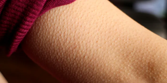 expresii piele de găină