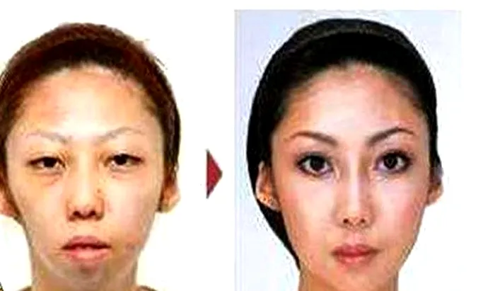 Soția lui Jian Feng înainte și după operațiile estetice