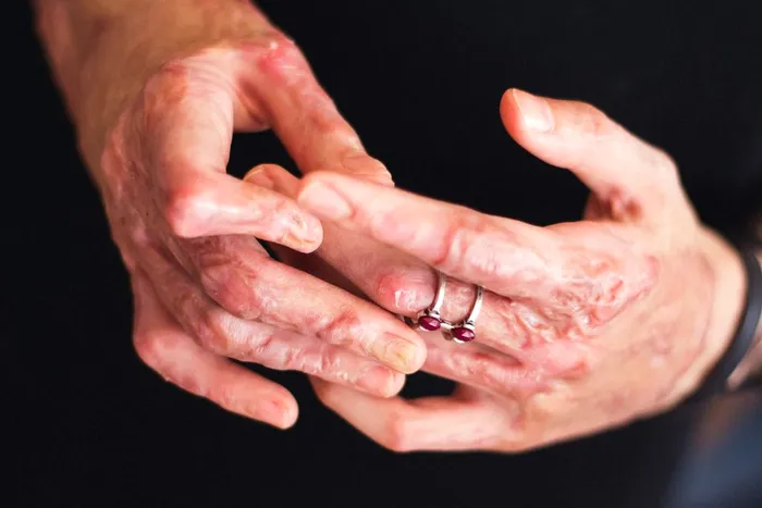 incendiul de la Colectiv