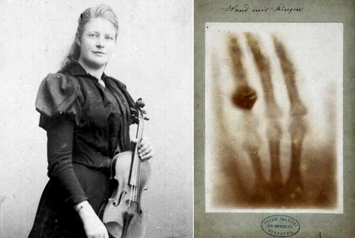 Amanda Röngten și o radiografie a mâinii acesteia