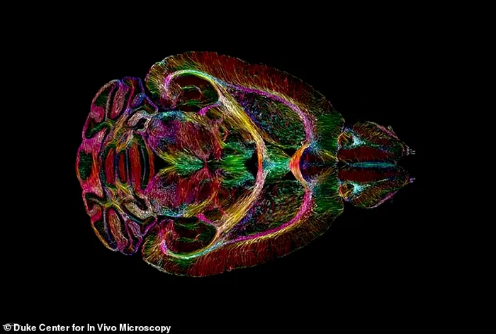 Cum arata un creier in imaginile captate de cele mai moderne aparate RMN. Detalii fara precedent. Foto