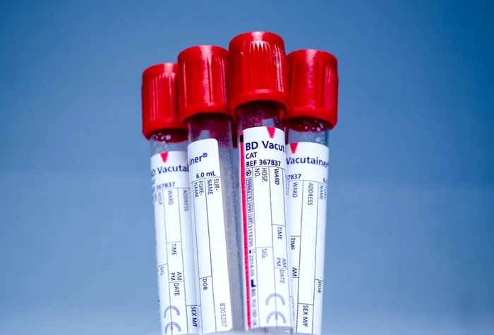 Grupe de sânge rare