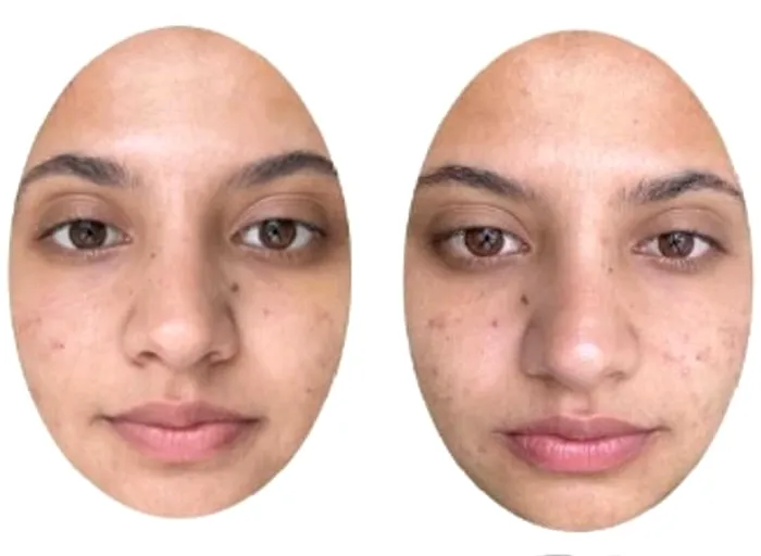 Participanților li s-au arătat și imagini cu această persoană în care crezi că arată cel mai bolnavă