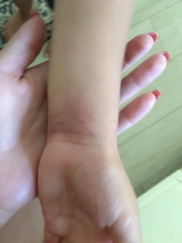 Copilul urla de durere din cauza mușcăturii veninoase a păianjenului