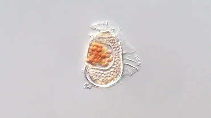 Microbul cu genom bizar de mic ar putea fi în curs de transformare într-un virus. Ce avertizează specialiștii